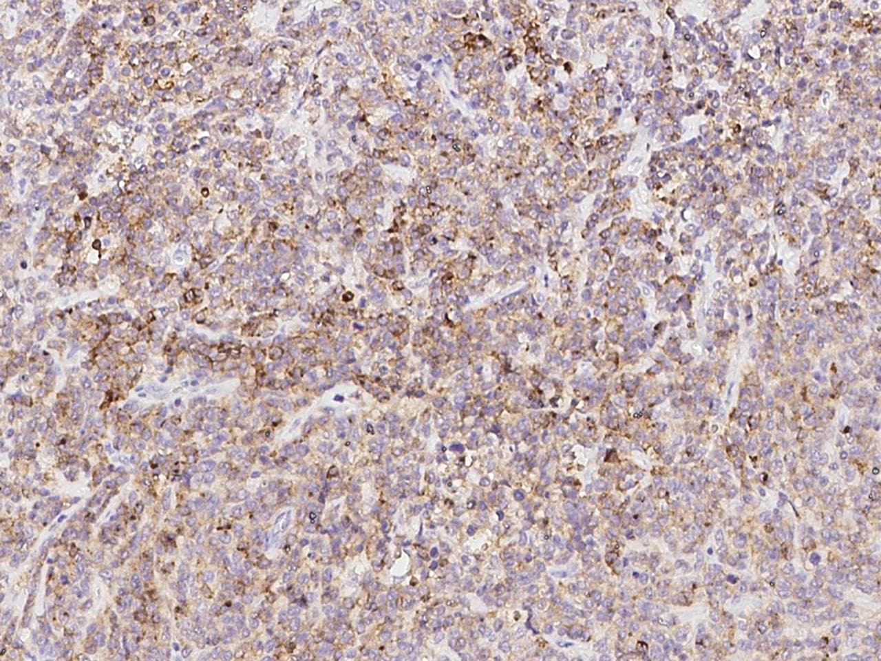 MME / CD10 Antibody (clone 13, Preservative Free)