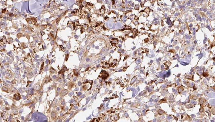 Polyclonal Rabbit anti-Human TFF1 / pS2 Antibody (IHC, WB)