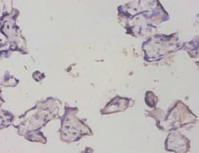 PTMA / Prothymosin Alpha Antibody