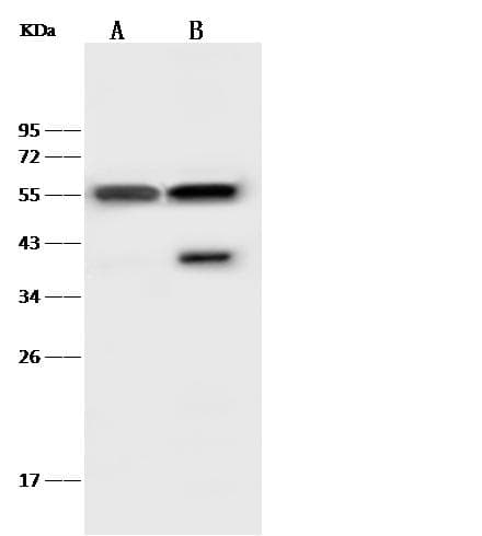 DES / Desmin Antibody (Preservative Free)