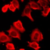 HCK Antibody