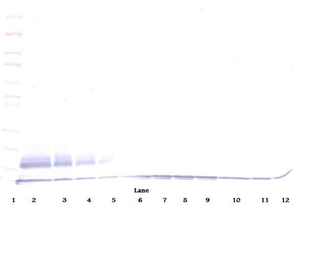 CCL22 / MDC Antibody