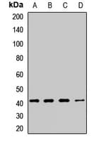 CTNS / Cystinosin Antibody