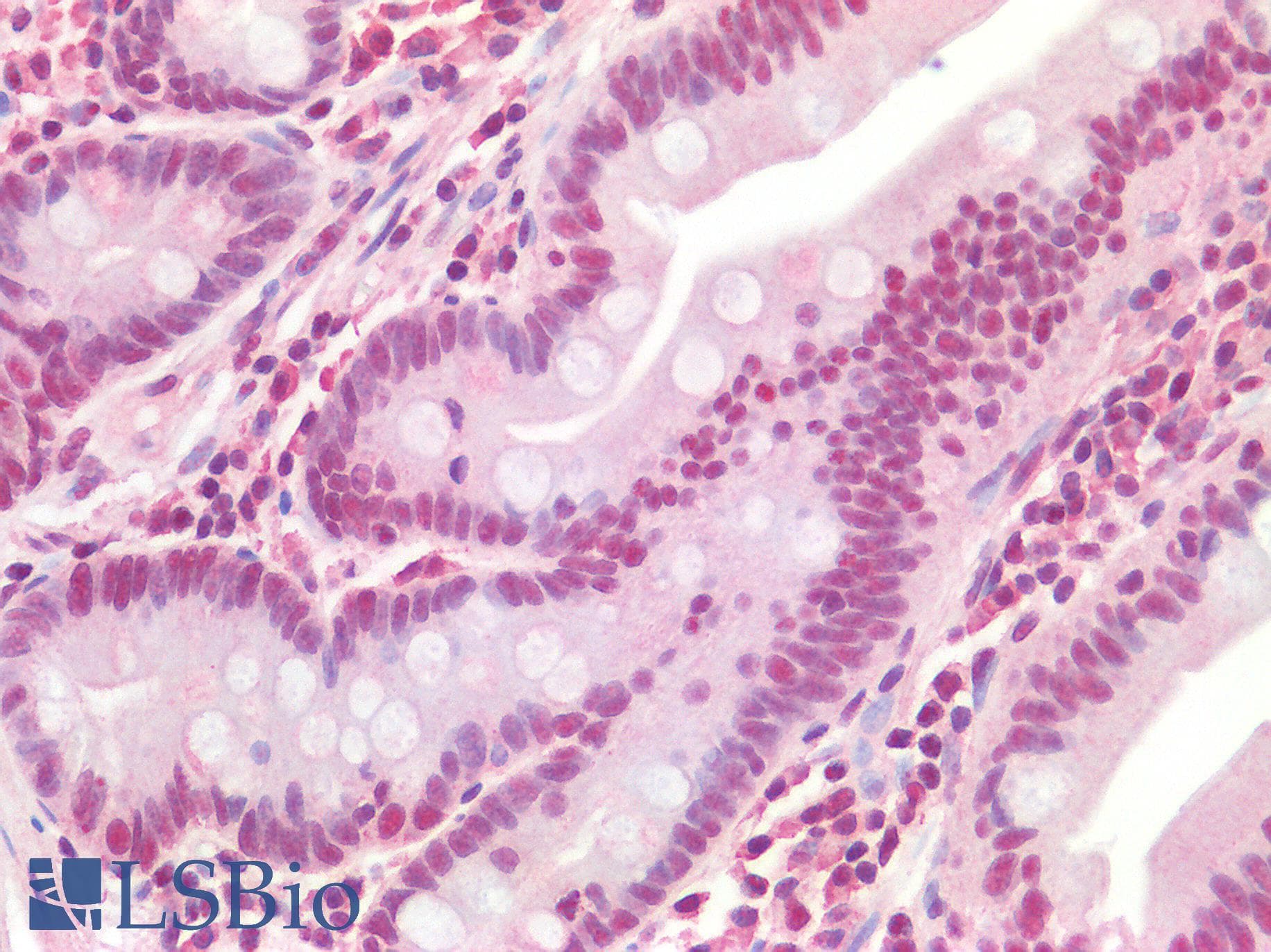 IHC-plus™ Polyclonal Goat anti-Human TICAM1 / TRIF Antibody (IHC)
