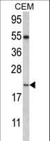 Polyclonal Rabbit anti-Human NANOS2 / NOS2 Antibody (aa108-137, IHC, WB)