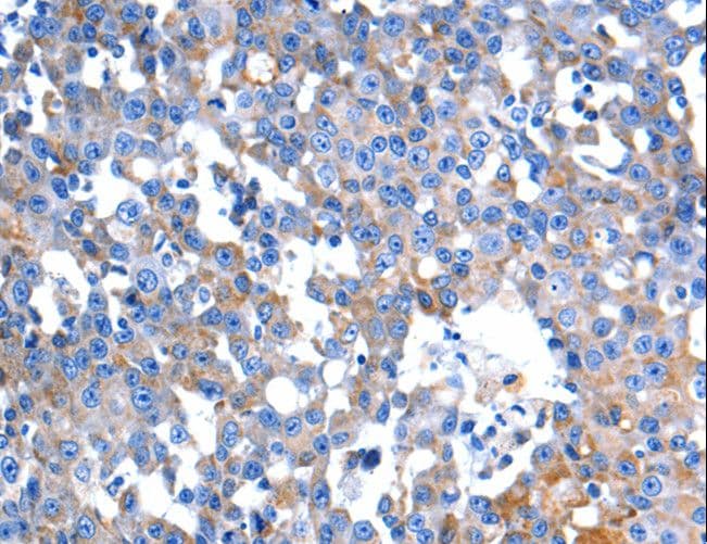 Polyclonal Rabbit anti-Human HINT2 Antibody (IHC)
