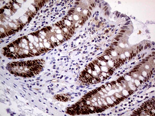 MAGEB4 Antibody (aa1-193, clone OTI1B5)