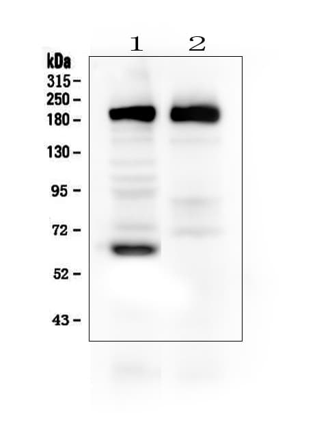 THBS2 / Thrombospondin 2 Antibody (aa637-655)