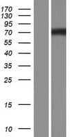 NPHP1 / Nephronophthisis Protein (Over-Expression Lysate Myc-DDK (Flag))