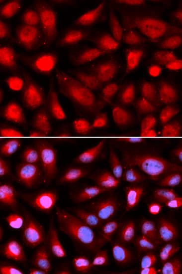 RPL5 / Ribosomal Protein L5 Antibody
