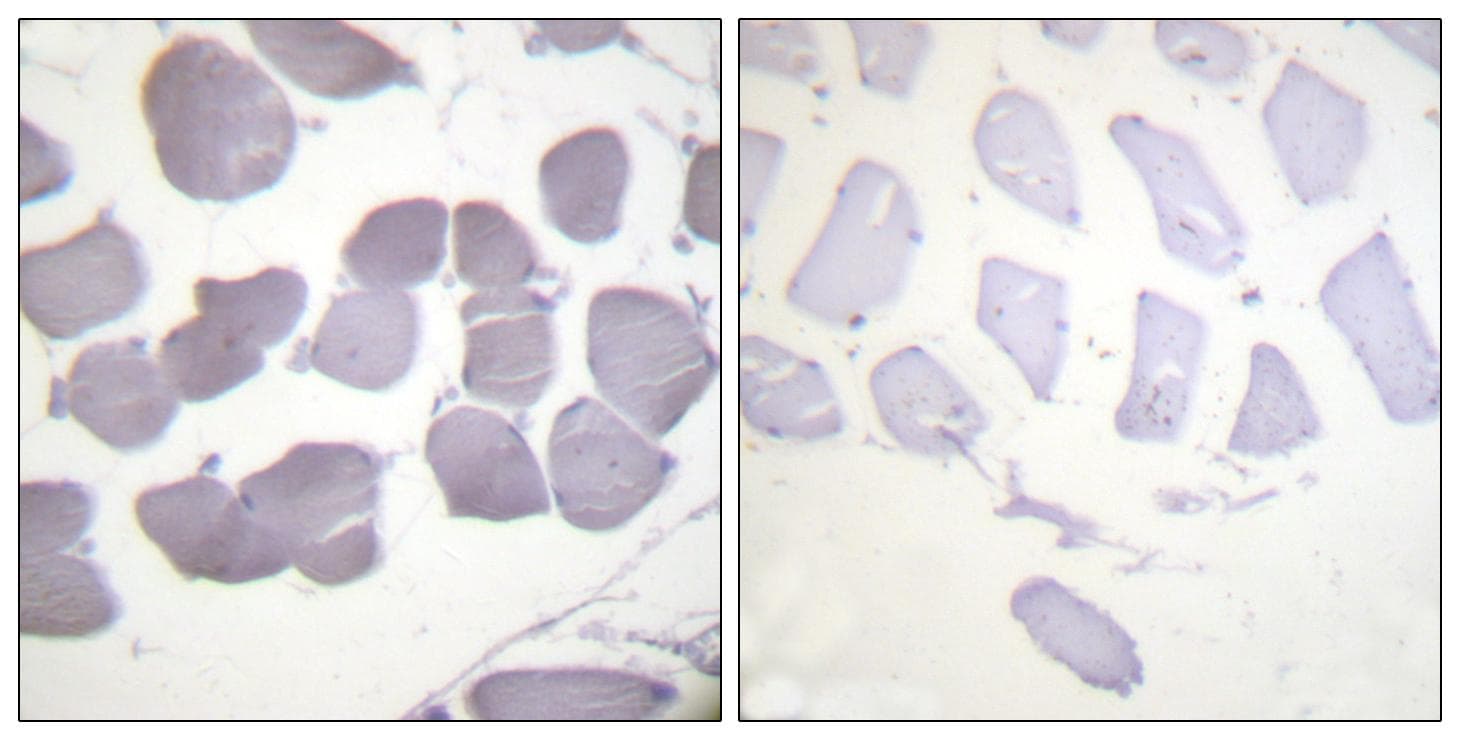 Polyclonal Rabbit anti-Human PRKAB1 / AMPK Beta 1 Antibody (phospho-Ser181, IHC, WB)