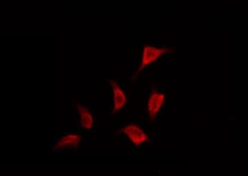 MAPT / Tau Antibody (phospho-Ser356)