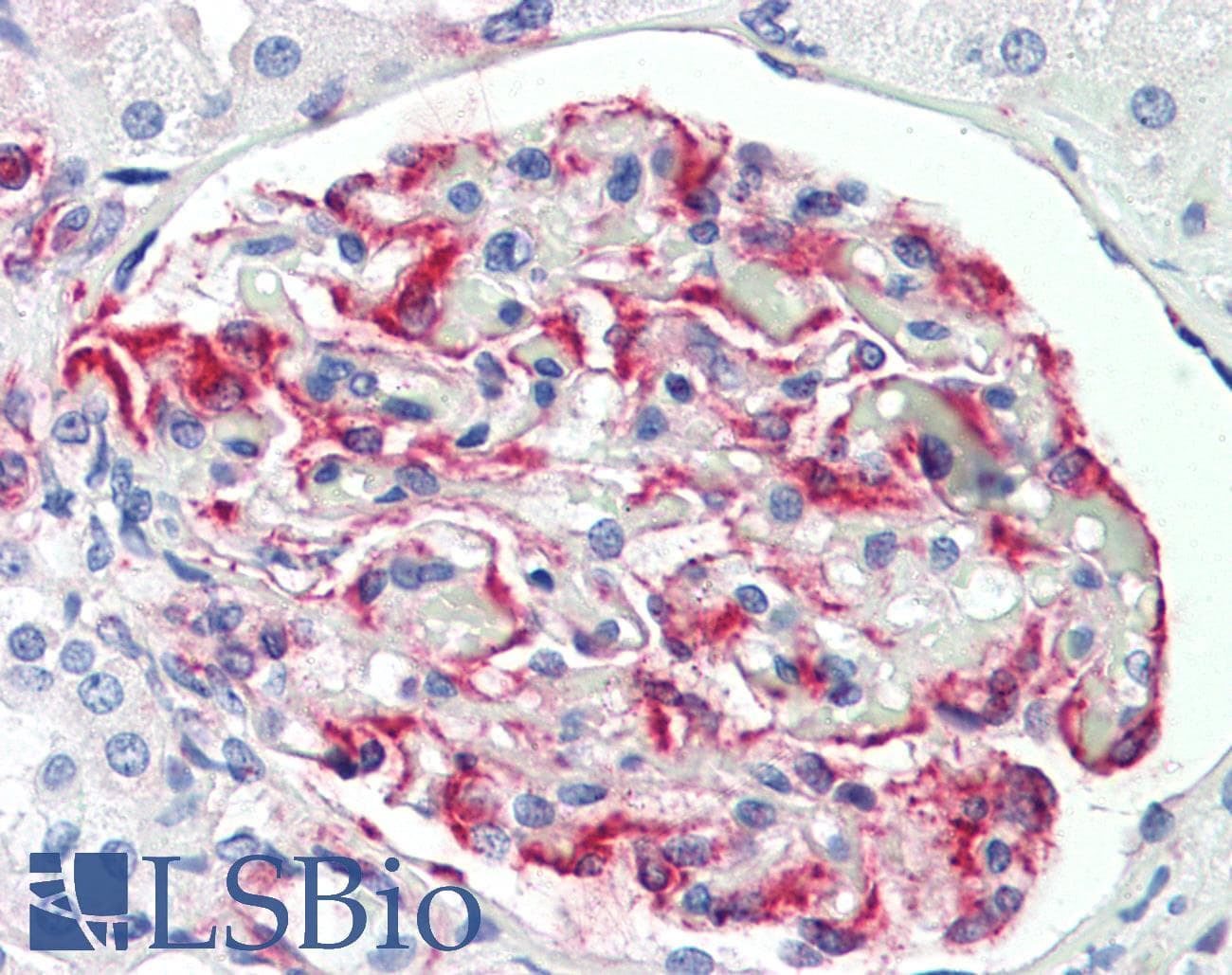 IHC-plus™ PEAK1 / SGK269 Antibody (aa673-699)