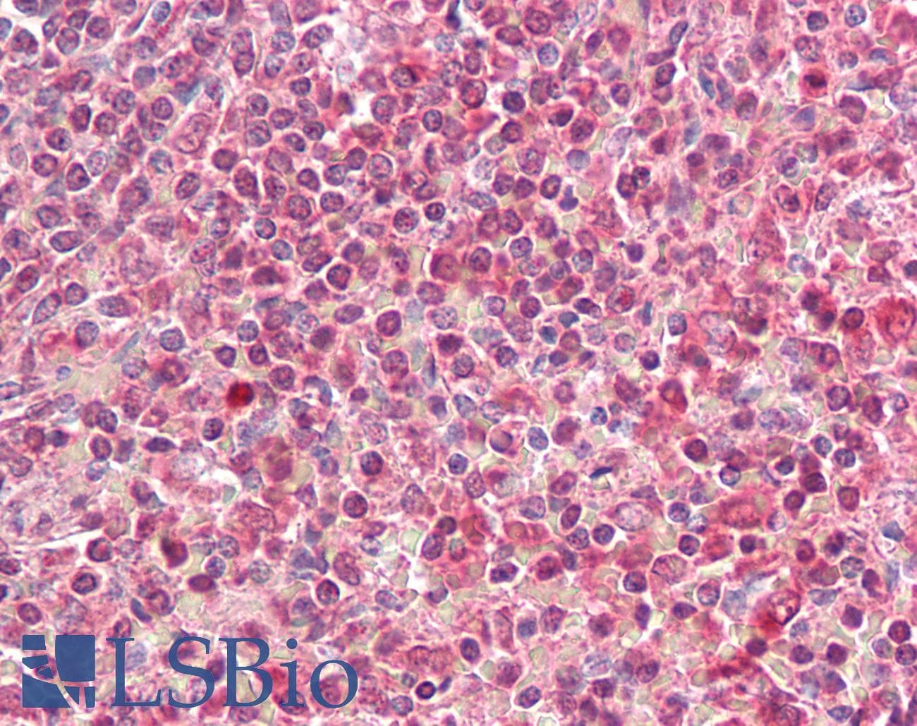 IHC-plus™ HLA-DQA2 Antibody (aa40-50)