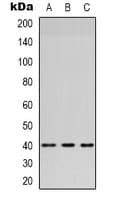 Polyclonal Rabbit anti-Human HSD3B7 Antibody (Internal, IHC, WB)