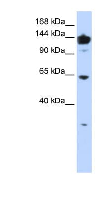 Polyclonal Rabbit anti-Human VARS / ValRS Antibody (aa576-625, IHC, WB)