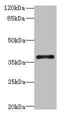 Polyclonal Rabbit anti-Human SUCNR1 / GPR91 Antibody