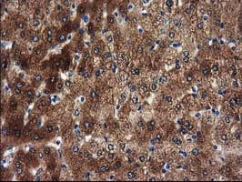 SULT1A1 / Sulfotransferase 1A1 Antibody (clone OTI1G10)