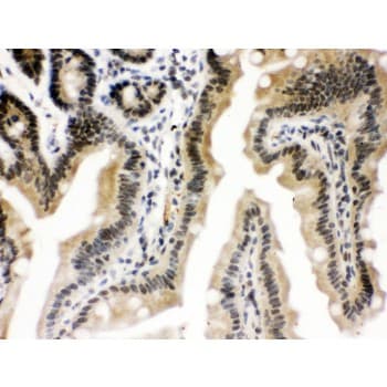 CTCF Antibody (aa521-727)
