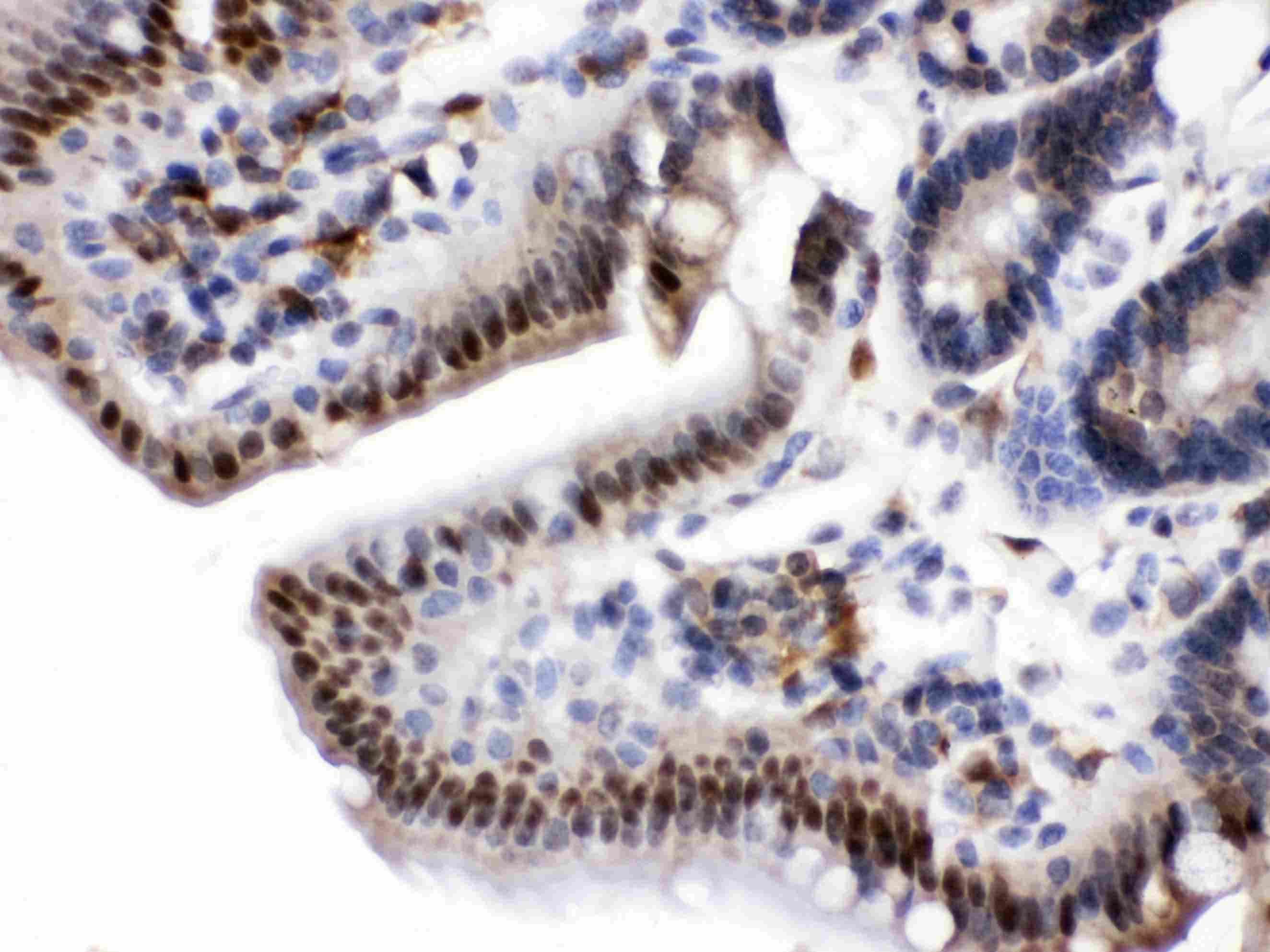 NAMPT / Visfatin Antibody