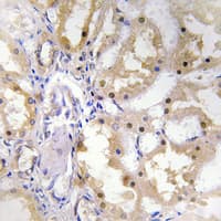 Polyclonal Rabbit anti-Human GZMH / Granzyme H Antibody (Internal, IHC, IF, WB)