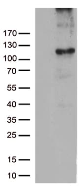 RB1 / Retinoblastoma / RB Antibody (aa309-590, clone OTI13A6)