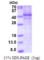 Human FOSL2 / FRA-2 Protein (Recombinant His)