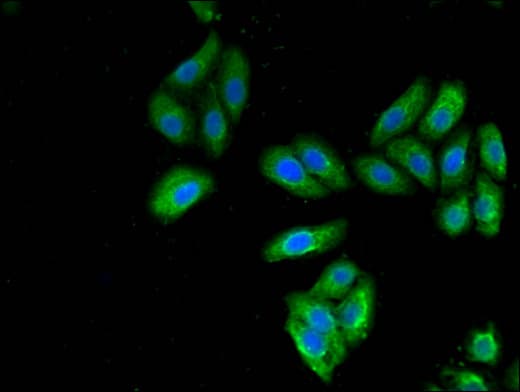 KRT7 / CK7 / Cytokeratin 7 Antibody