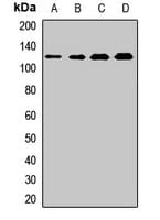 BUB1 Antibody