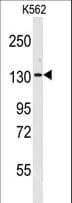 VARS / ValRS Antibody (aa251-279)