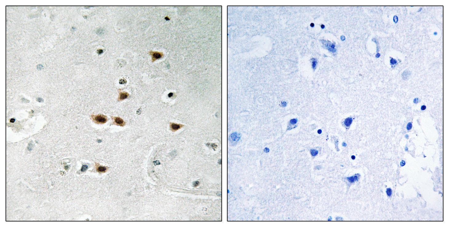 ITCH / AIP4 Antibody (phospho-Tyr420)