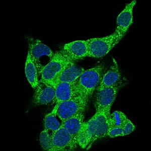 CD14 Antibody (aa20-214, clone 1H5D8)