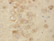 PSEN2 / Presenilin 2 Antibody (aa319-334)