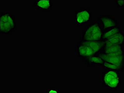 Polyclonal Rabbit anti-Human TMEM173 / STING Antibody (IHC, IF, WB)