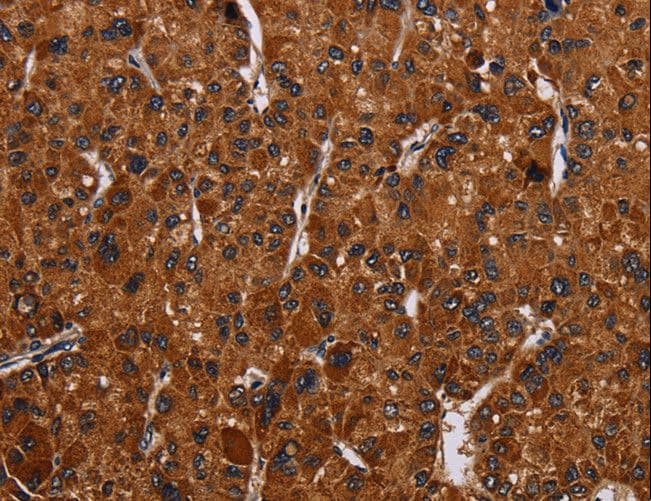 RTN4R Antibody