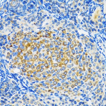 SIRT2 / Sirtuin 2 Antibody