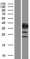 OGG1 Protein (Over-Expression Lysate Myc-DDK (Flag))