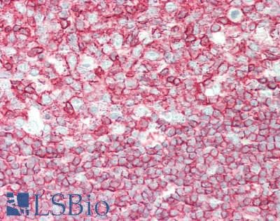 PathPlus™ Polyclonal Goat anti-Human CD45 / LCA Antibody (C-Terminus, IHC, WB)