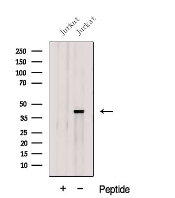 GNAQ Antibody