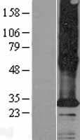 Human TMEM185A / FAM11A Protein (Over-Expression Lysate Myc-DDK (Flag))