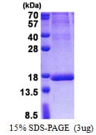 Human ISOC2 Protein (Recombinant His)