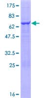 Human TRIM5 Protein (Recombinant GST)