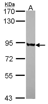 Polyclonal Rabbit anti-Human PNPT1 Antibody (aa25-251, IHC, WB)