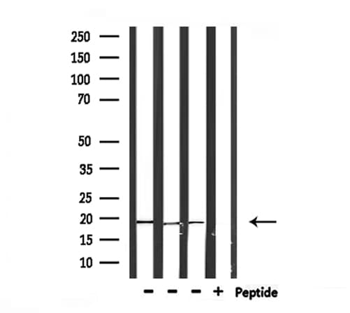 Polyclonal Rabbit anti-Human PTP4A3 Antibody (IHC, IF, WB)