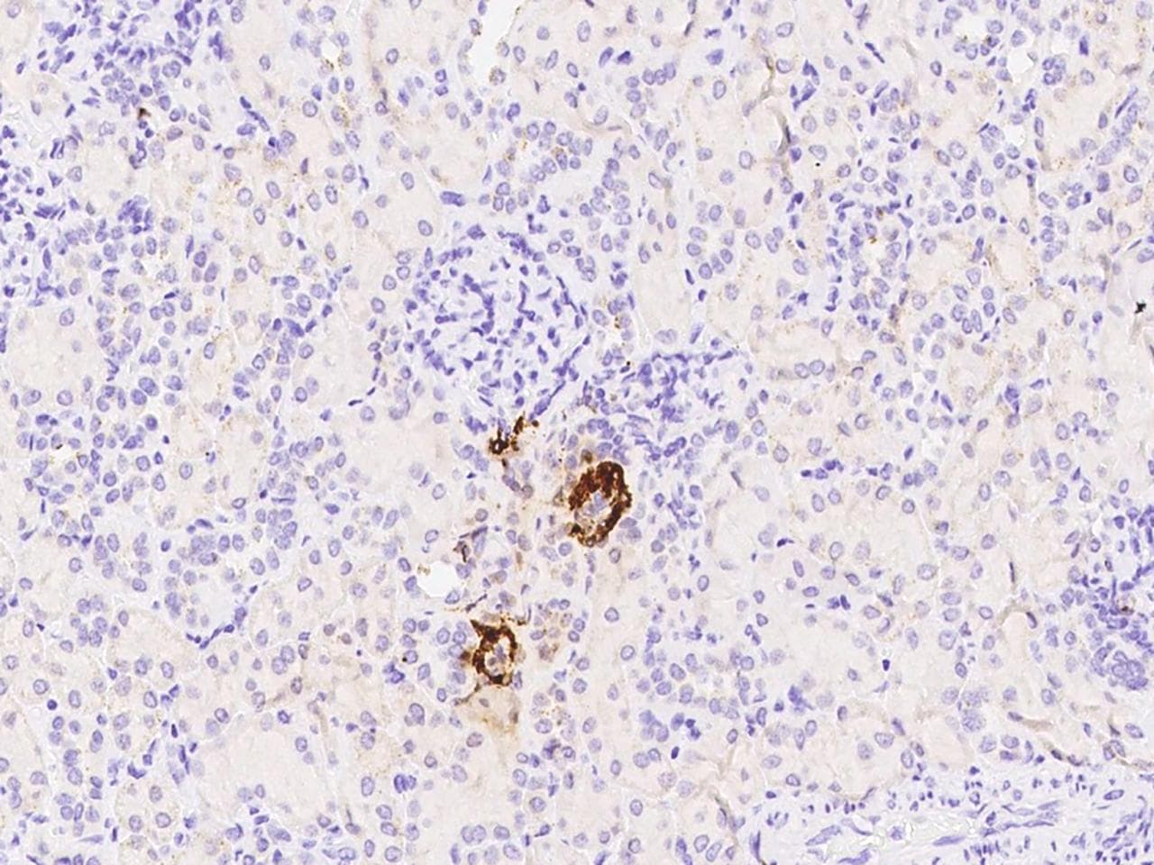 REN / Renin 1 Antibody (Preservative Free)