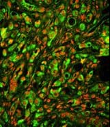 PTP4A2 / PRL-2 Antibody (aa32-59)