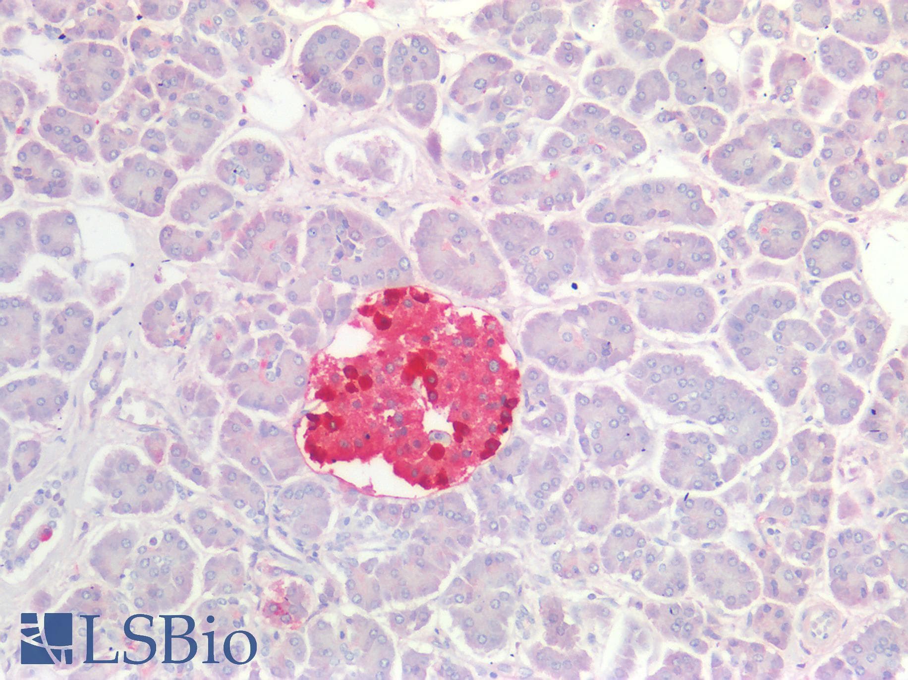 IHC-plus™ TTR / Transthyretin Antibody