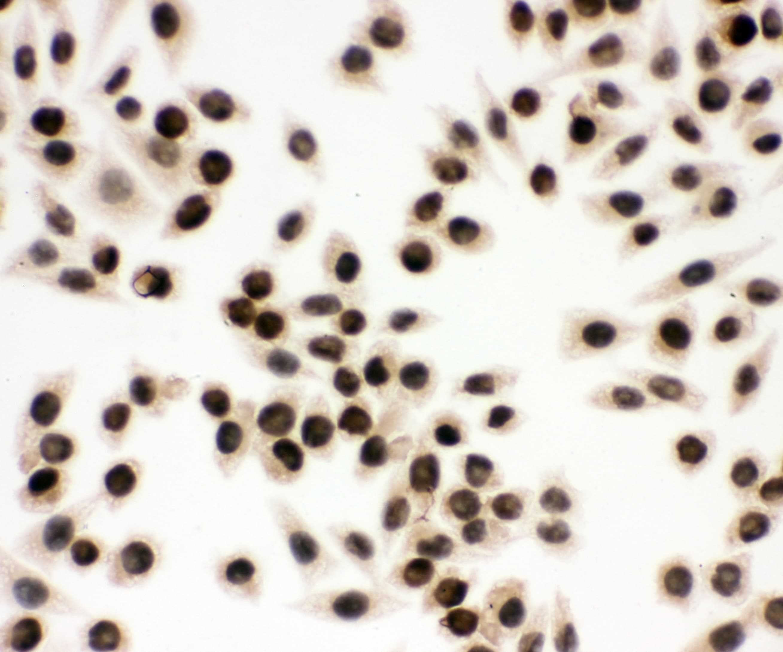 EWSR1 / EWS Antibody (aa369-399)