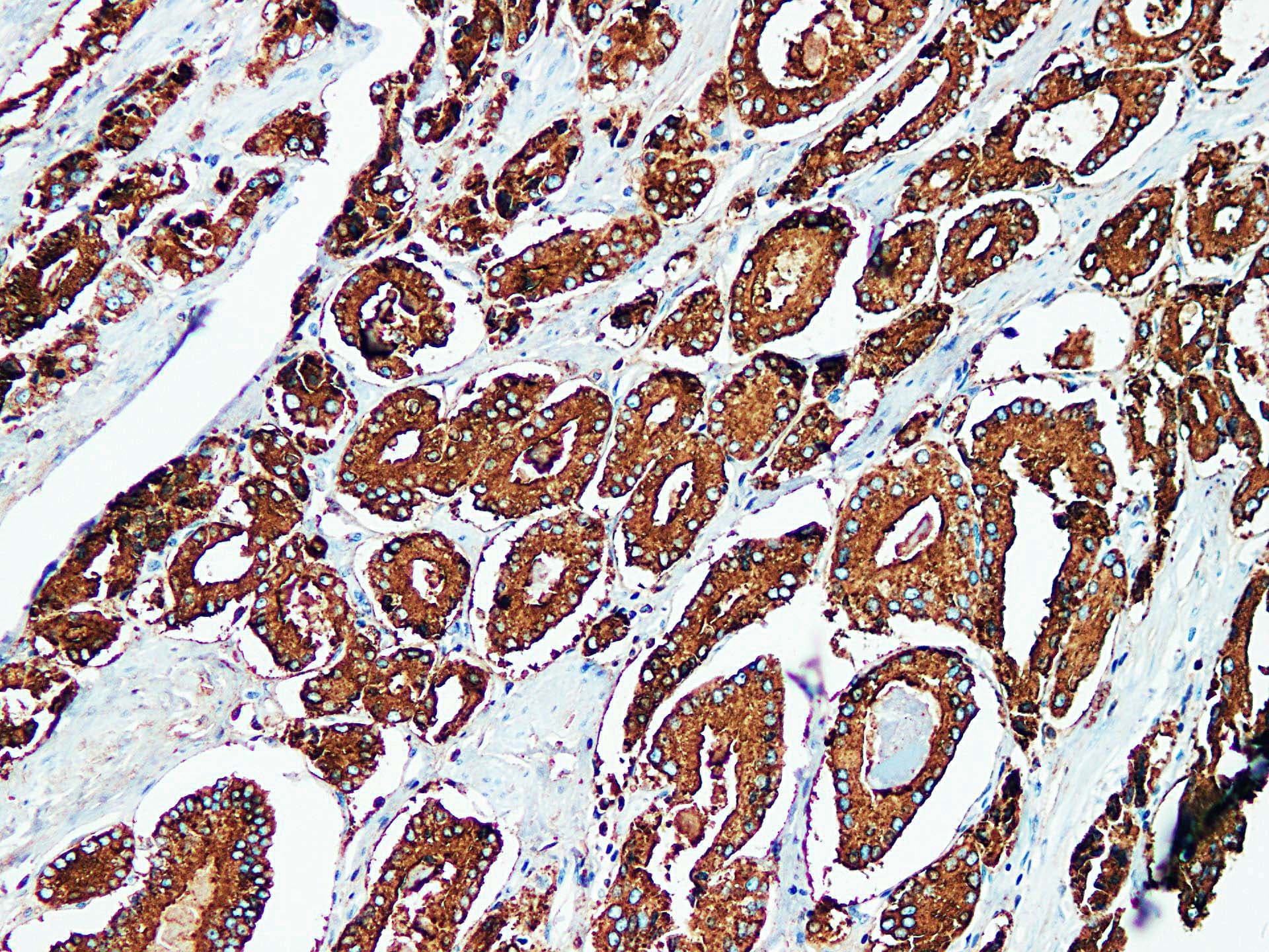 Monoclonal Mouse anti-Human ACPP / PAP Antibody (clone ABT-PSAP, IHC)