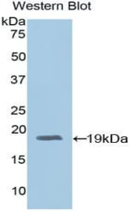 ADM / Adrenomedullin Antibody (aa24-171)